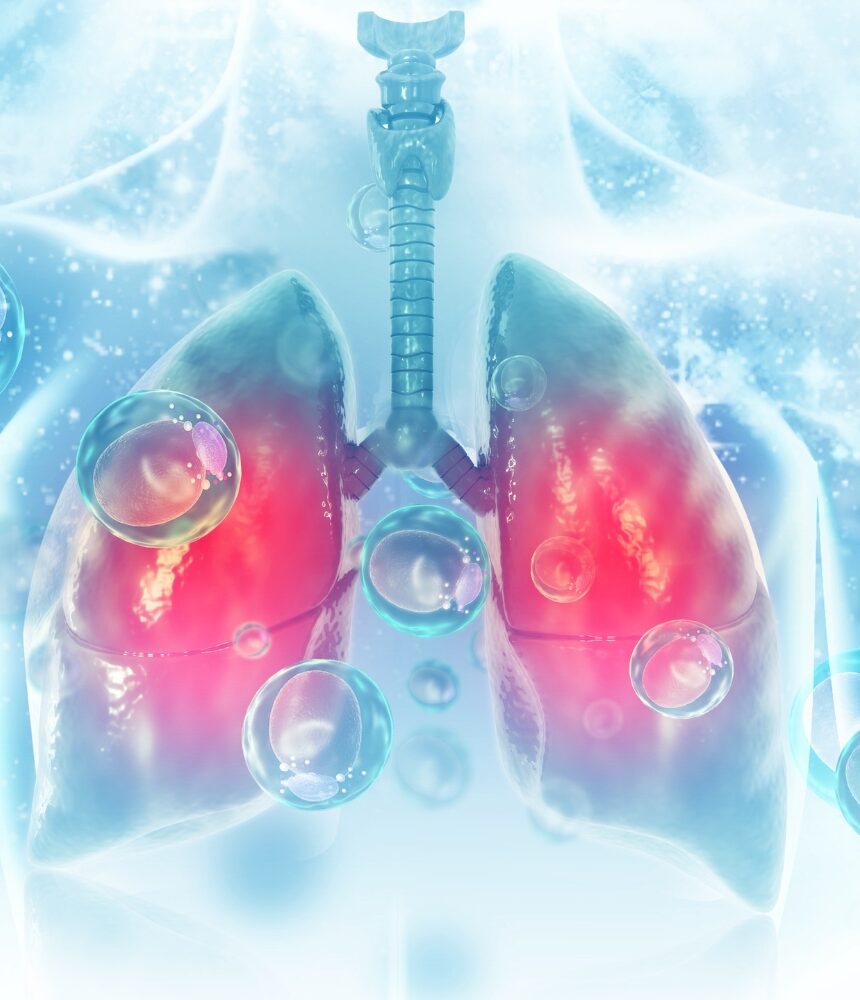 Respiratory Medicine service at Leuaina General Hospital